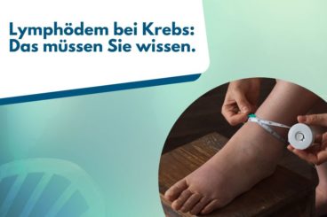 Therapiebericht Lymphdrainage – Was Sie über die Behandlung wissen sollten 4 Lymphdrainage anwendung bei lymphoedem