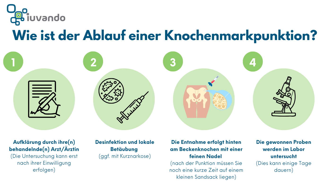 Schritt-für-Schritt-Ablauf einer Knochenmarkpunktion, dargestellt in vier Schritten: Aufklärung, Desinfektion und Betäubung, Punktion am Becken mit Nadel, und Laboruntersuchung der gewonnenen Proben.