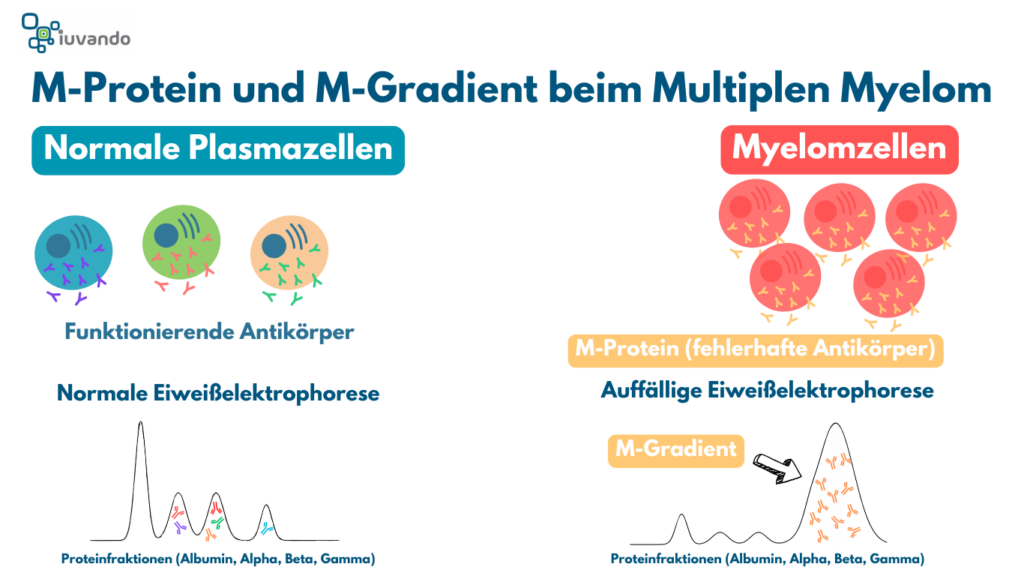 Schematische Darstellung einer Serumprotein-Elektrophorese: Die Kurve zeigt typische Proteinfraktionen im Blut mit einem auffälligen M-Gradienten im Gamma-Bereich, der auf monoklonale Proteine hinweist.