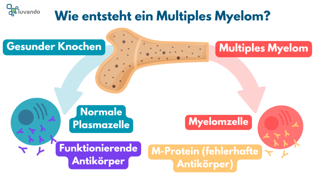 Wie entsteht ein Multiples Myelom, Darstellung von normaler Plasmazelle mit funktionierenden Antikörpern und Myelomzelle mit M-Protein (fehlerhaften Antikörpern)