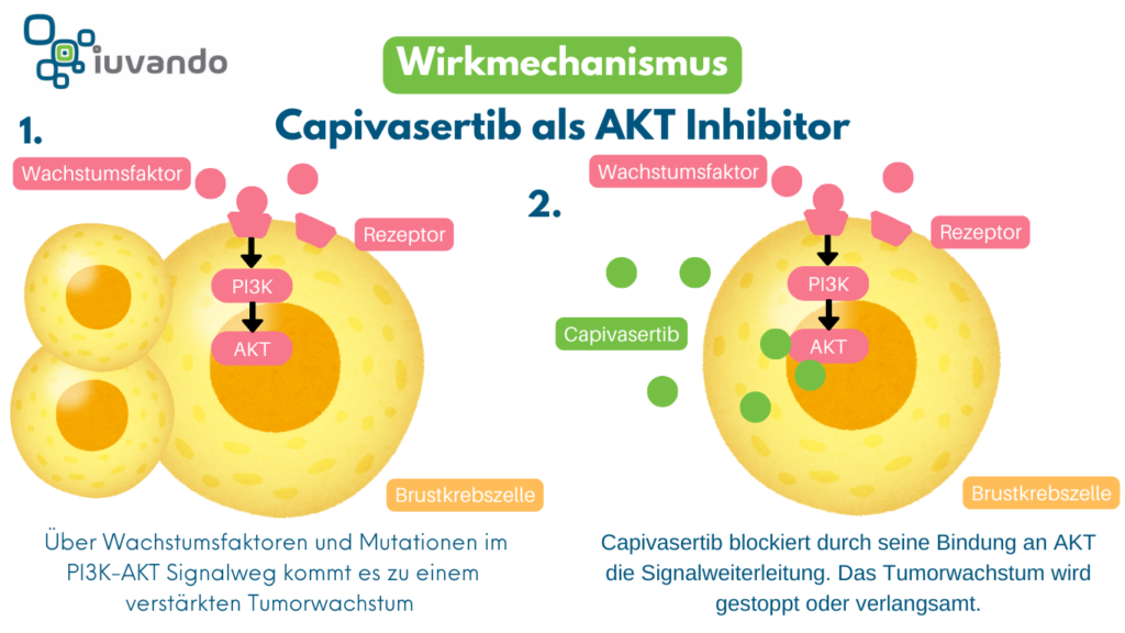 Schematische Darstellung des Wirkmechanismus von Capivasertib als AKT Inhibitor beim Brustkrebs.