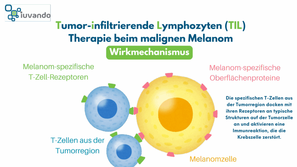 Schematische Darstellung der Tumor-infiltrierenden Lymphozyten Therapie beim Melanom