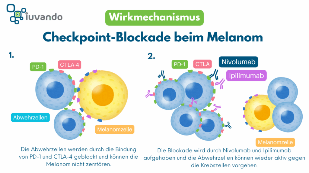 Schaubild zum Wirkmechanismus der Checkpointblockade/Immuntherapie beim metastasierten Melanom (schwarzer Hautkrebs)